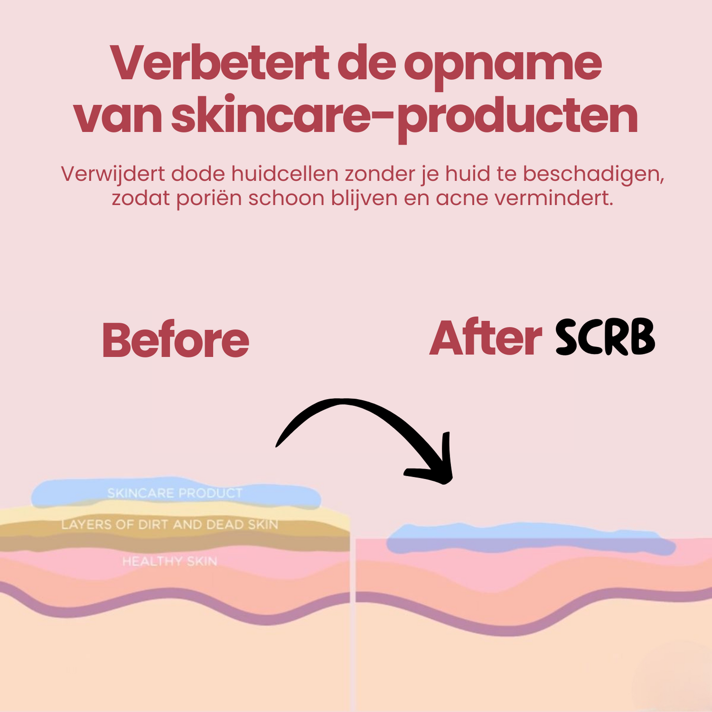 SCRB body™